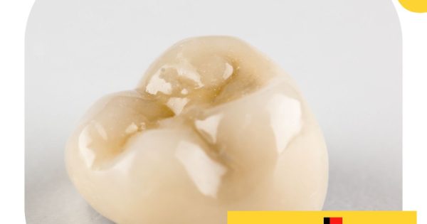 Benefits And Risks Of Dental Crowns Sachem Dental Group