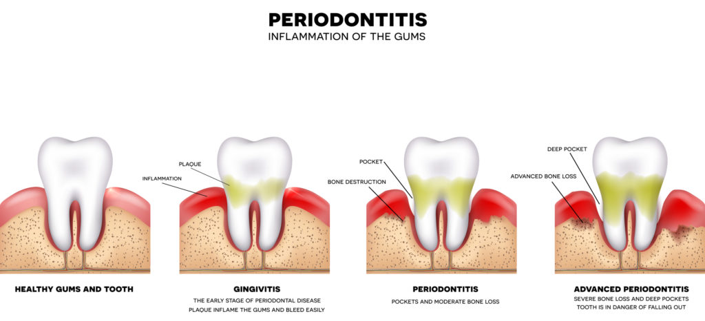 long island gum disease periodontist