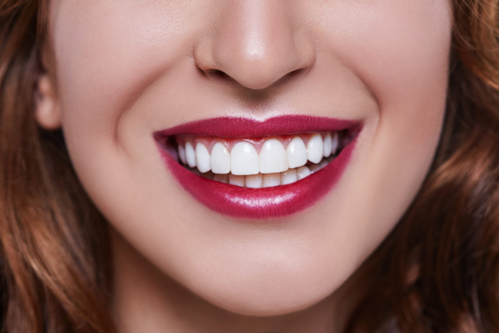 long island dental veneers cost