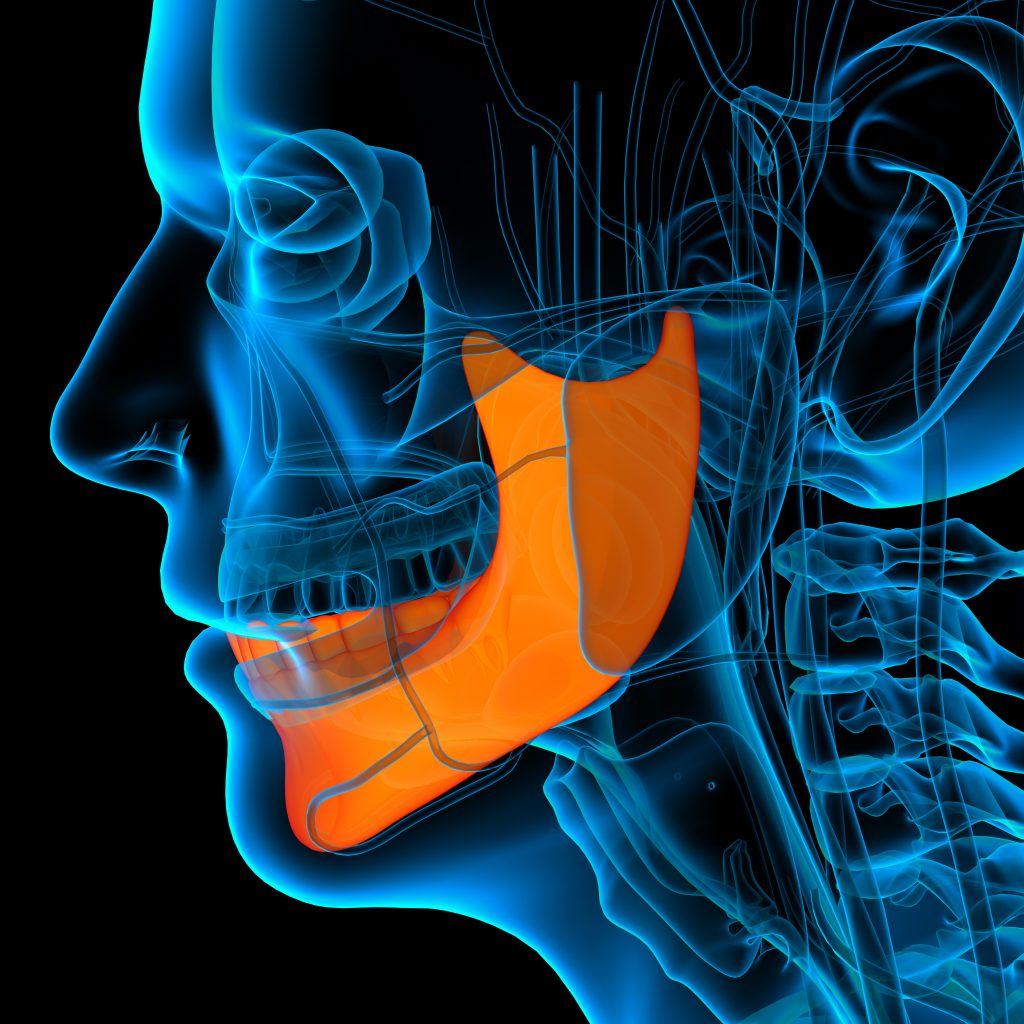 Jaw Surgery Suffolk County Long Island Sachem Dental