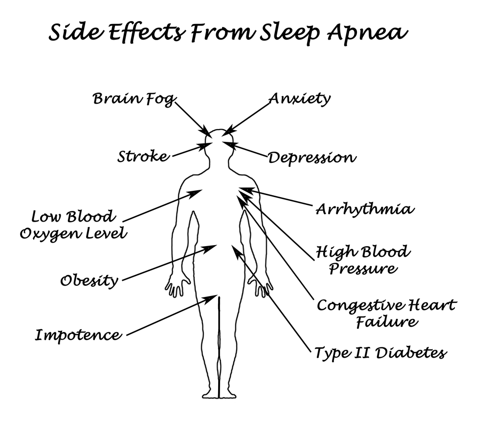 Sleep Apnea and Sleeping Disorders Sachem Dental Group