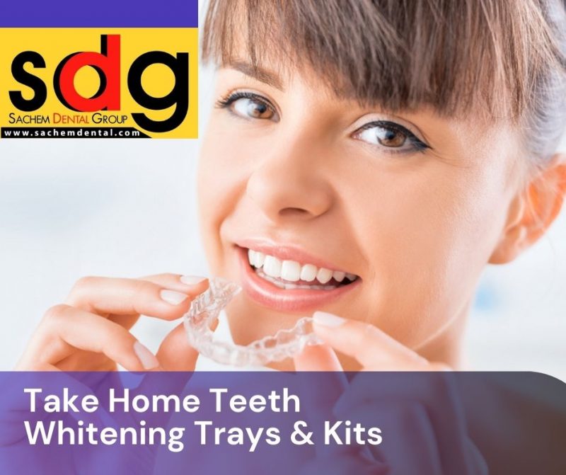 How To Whiten Dentures With Bleach - Thebabcockagency