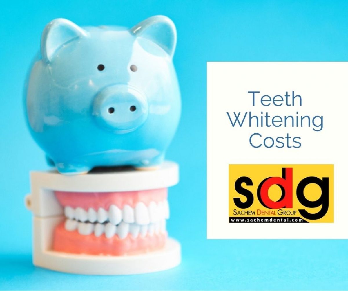 Cost of Teeth Whitening Sachem Dental Group