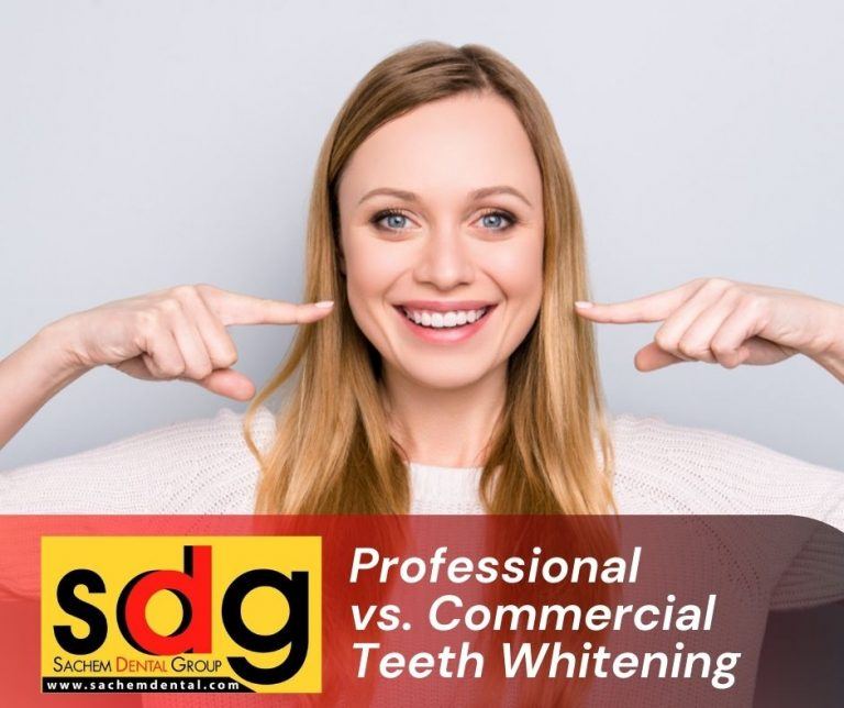 Professional teeth whitening vs home kits