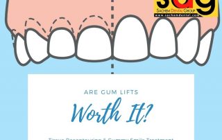 benefits and risks of gum lifts
