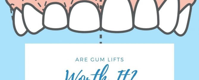 benefits and risks of gum lifts