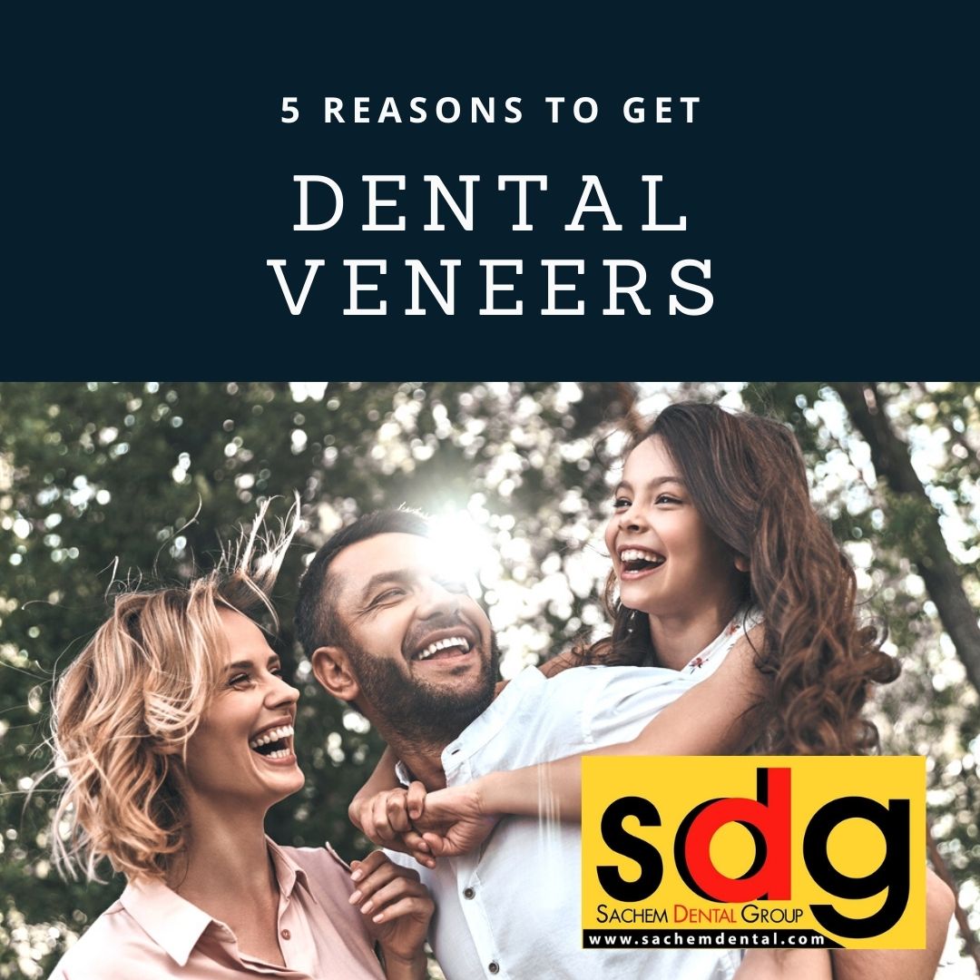 reasons to get dental veneers