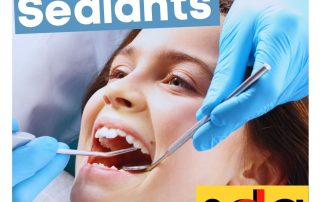 dental sealants in Long Island