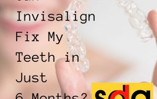 fast Invisalign treatment
