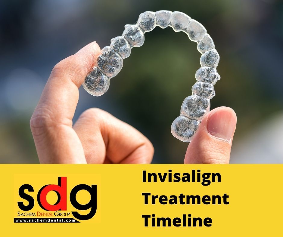 timeline for Invisalign treatment