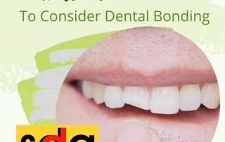 should I get dental bonding