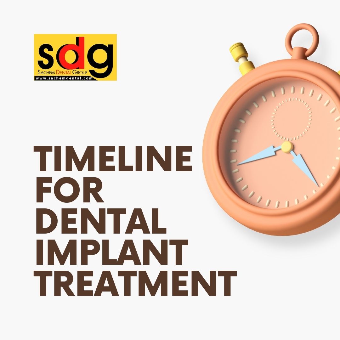 time requirements for dental implant treatment