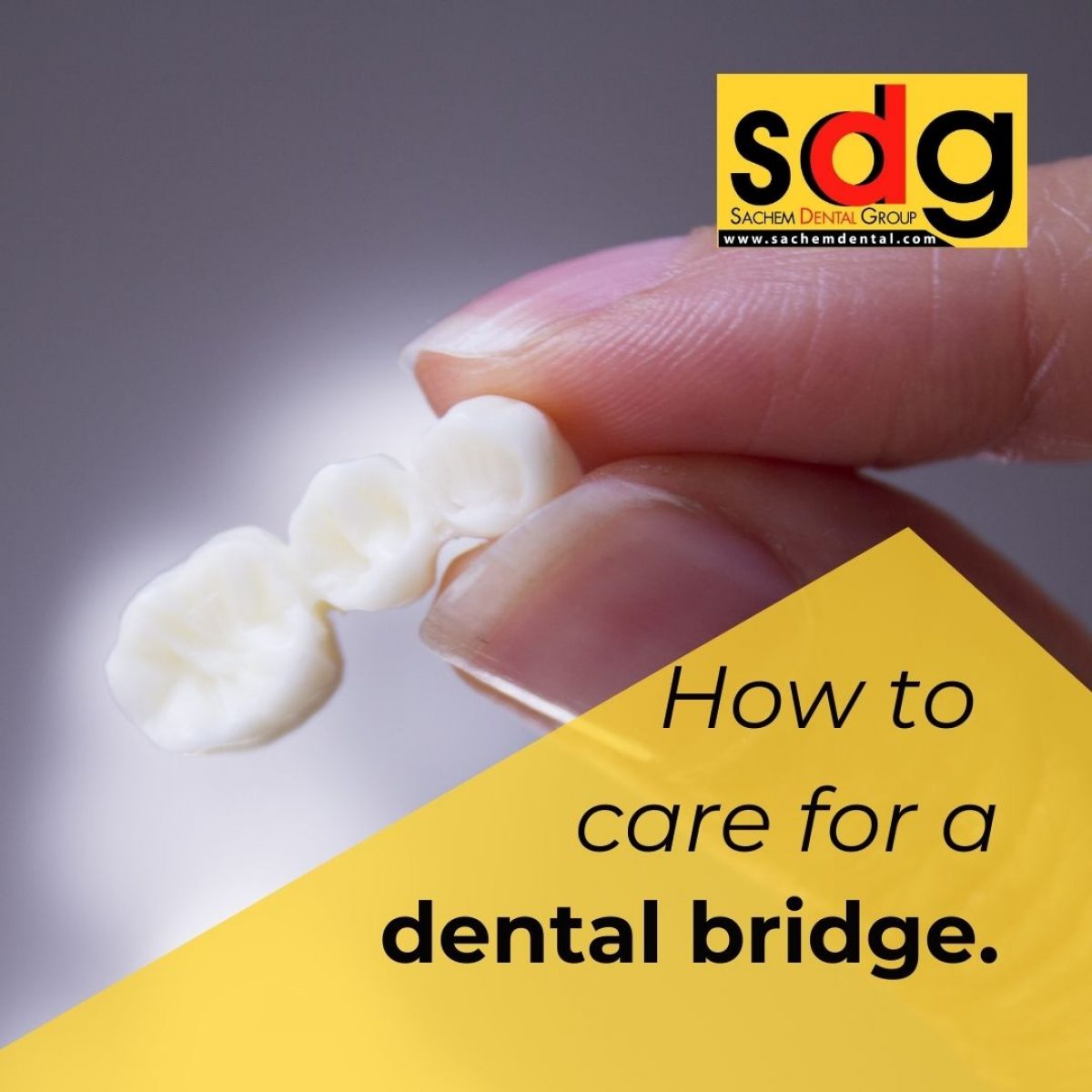 How To Care For My Dental Bridge Sachem Dental Group
