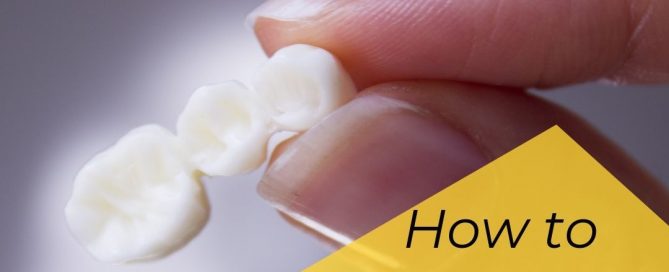 how to clean a dental bridge