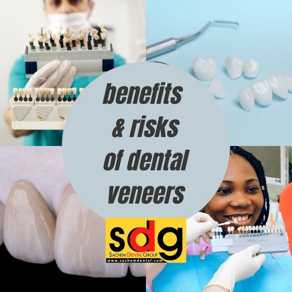 Porcelain Veneers Benefits and Risks Sachem Dental Group