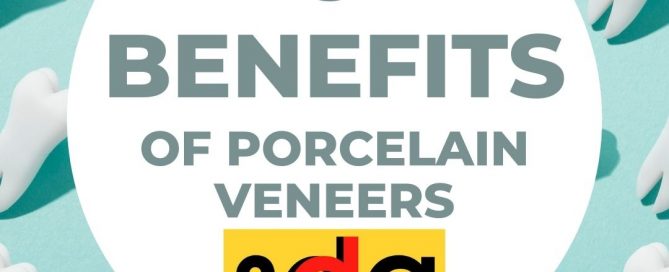 advantages of cosmetic veneers