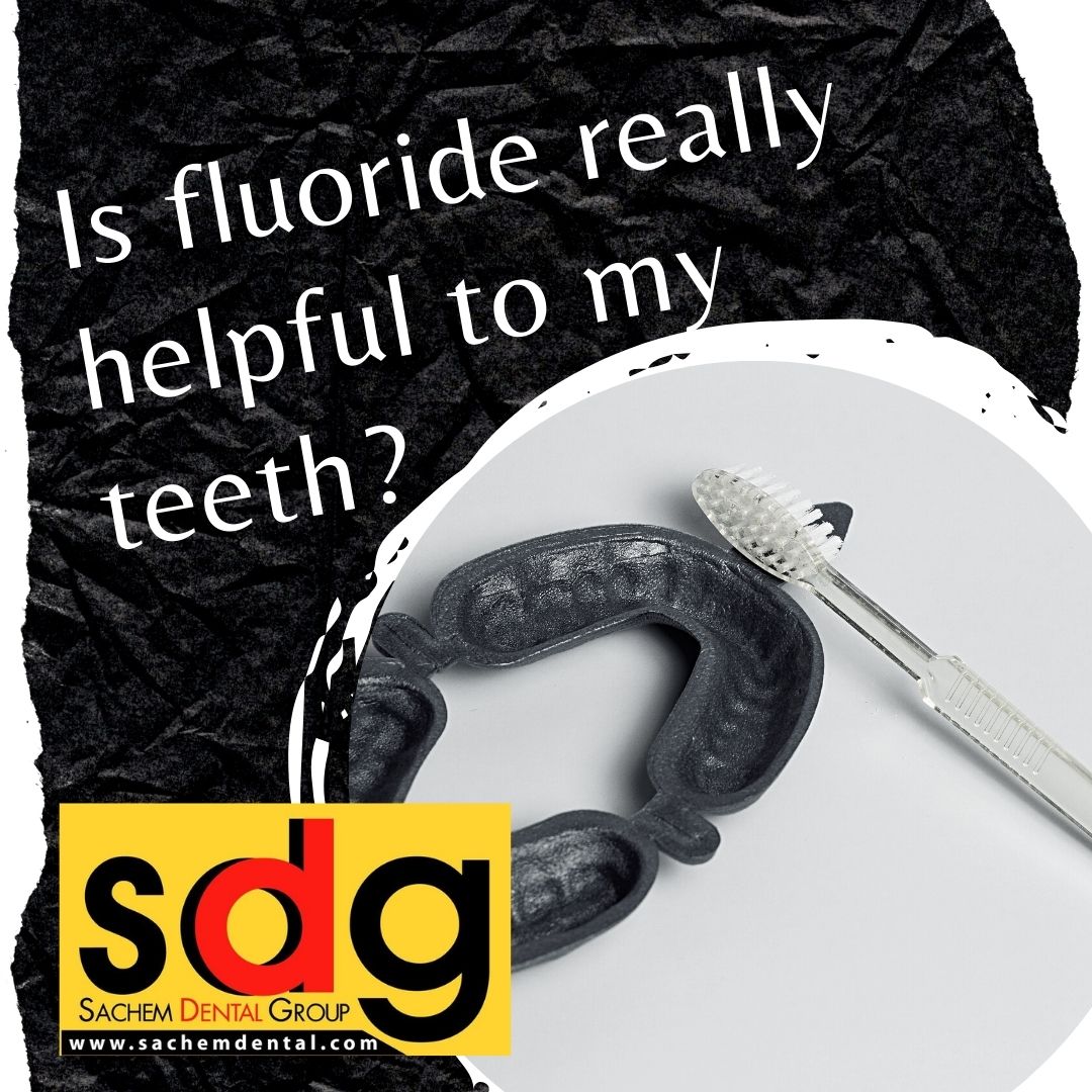 is fluoride good for my teeth