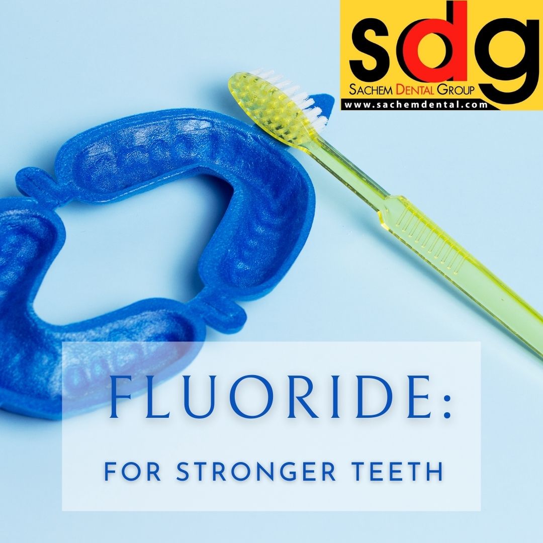 is fluoride treatment good for you?