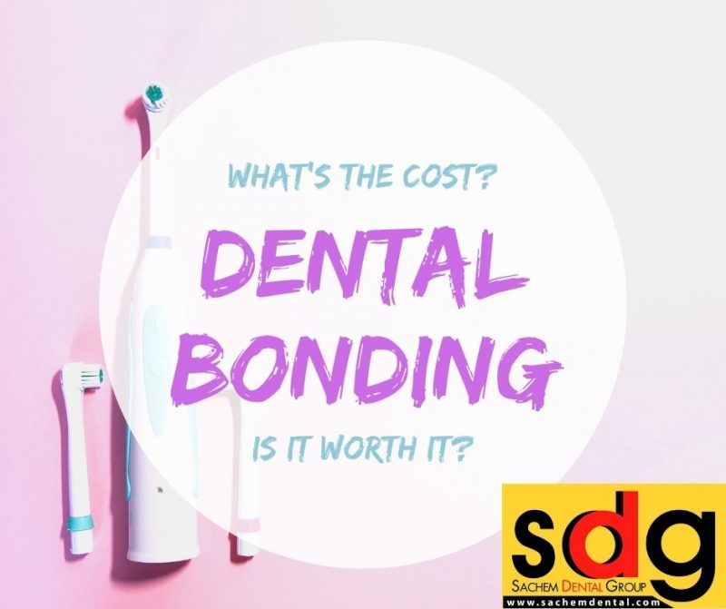 Cost of Dental Bonding Sachem Dental Group