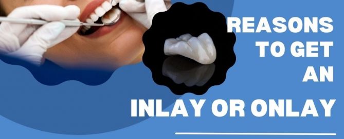 dental inlays and onlays