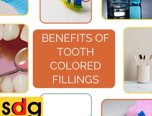 Benefits of Tooth-Colored Fillings