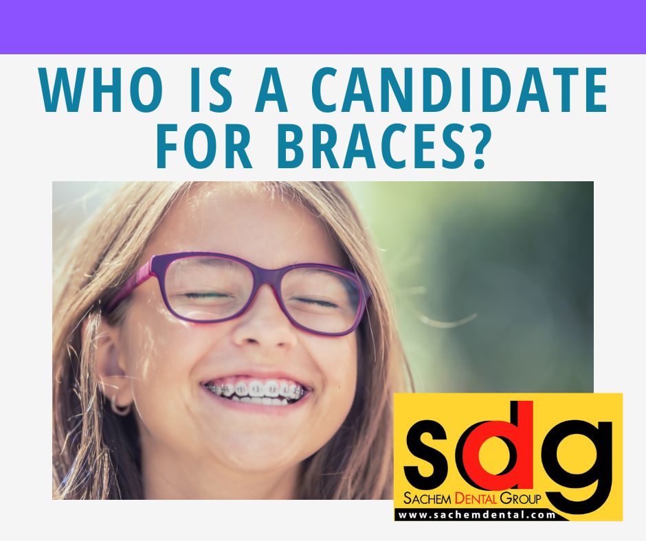 candidate for braces