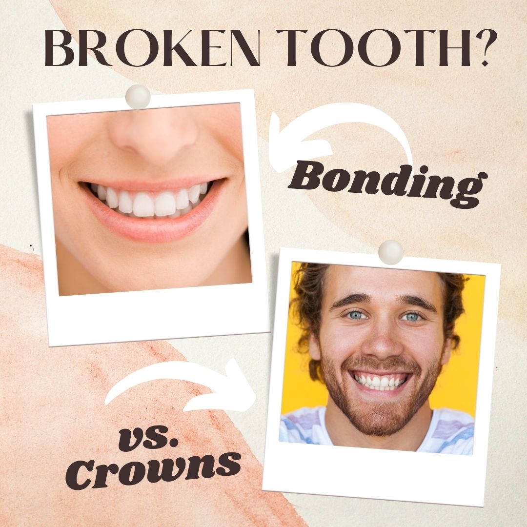 Missing, Damaged, Broken Teeth - Implants, Bonding & Crowns