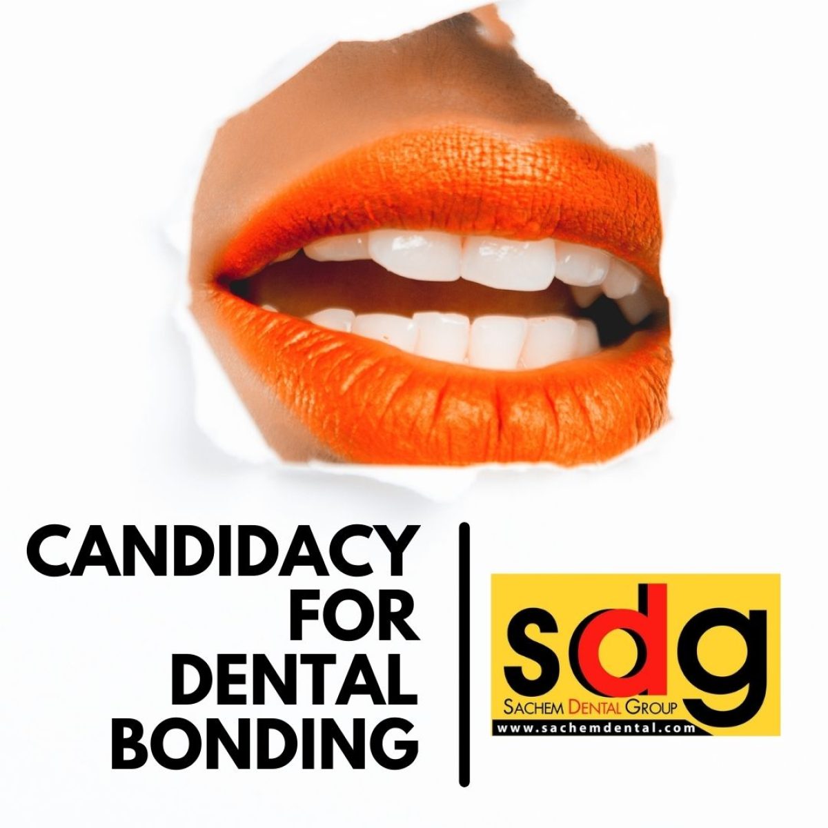 Candidacy for Dental Bonding Sachem Dental Group