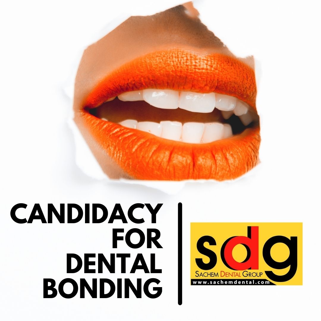 candidacy for dental bonding