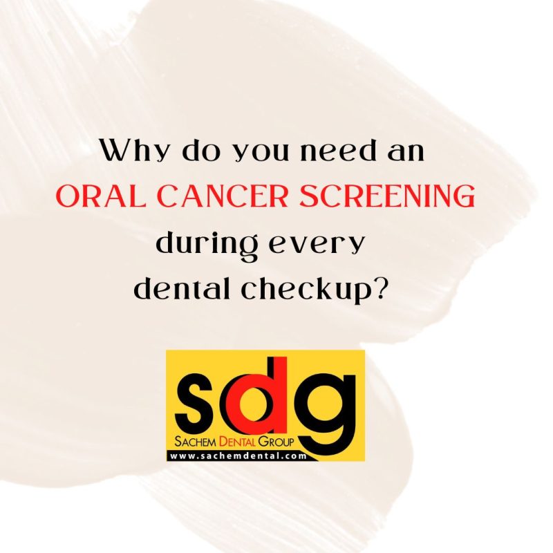 dentist-in-clemmons-nc-what-you-need-to-know-about-oral-cancer-screening