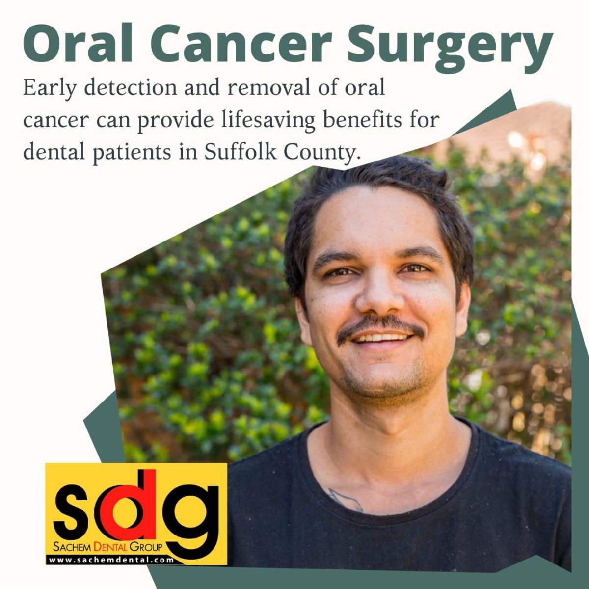 oral cancer surgery