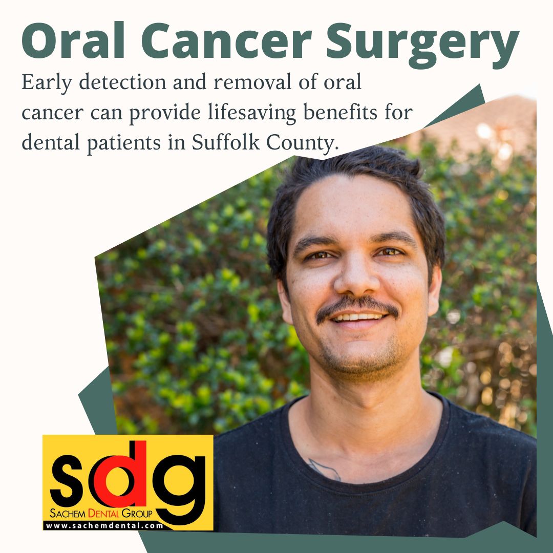 why is oral cancer surgery necessary