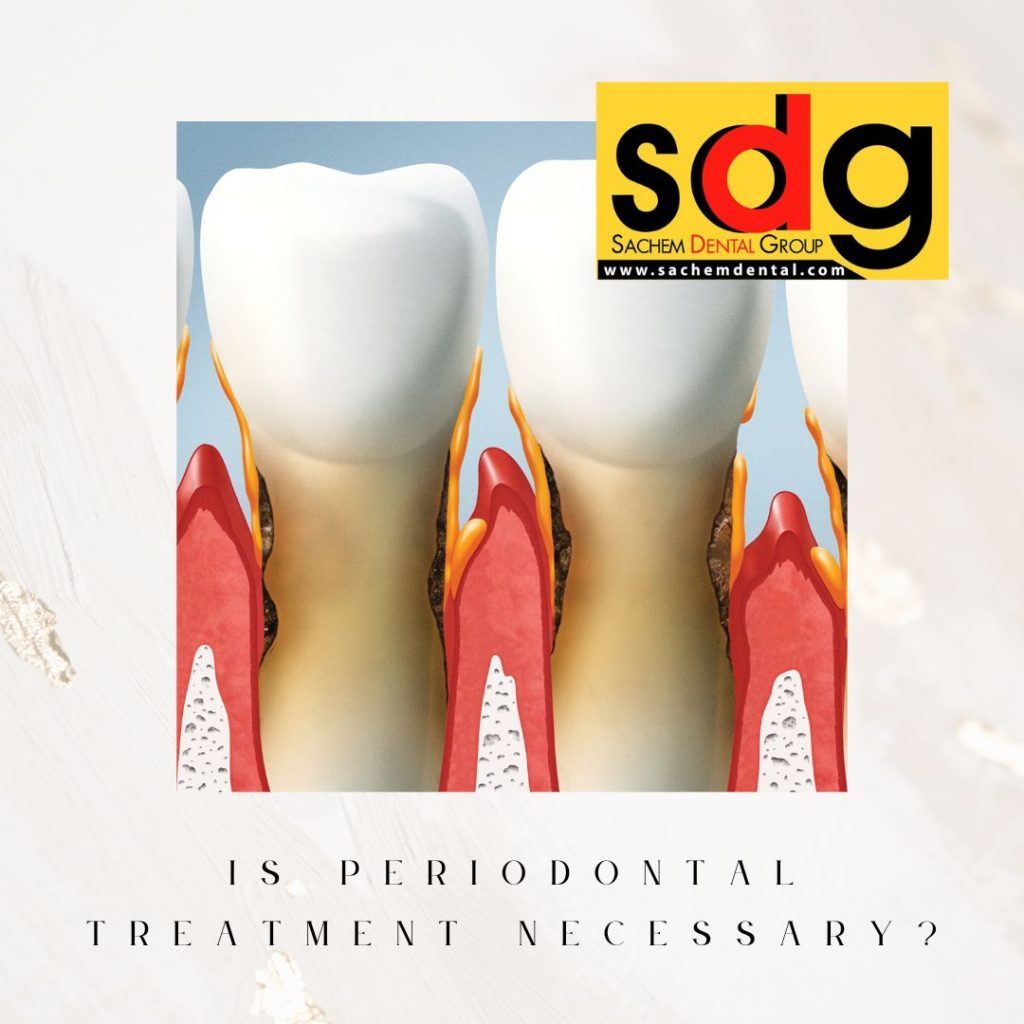 do i need periodontal therapy