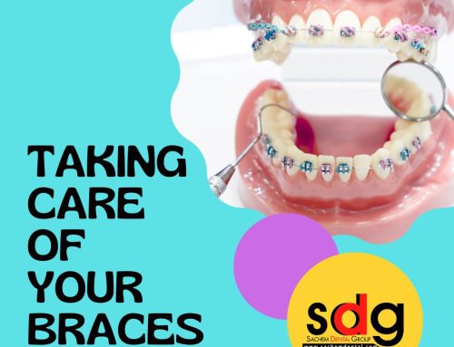Top Tips for Taking Care of Your Traditional Braces