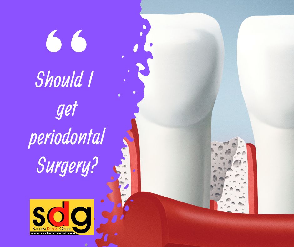 periodontal surgery