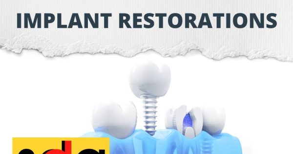 What Is Dental Implant Restoration Sachem Dental Group 7927