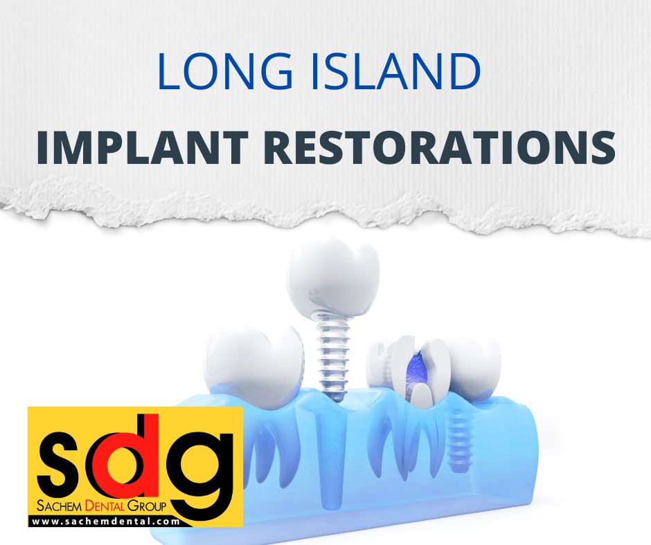long island implant restoration