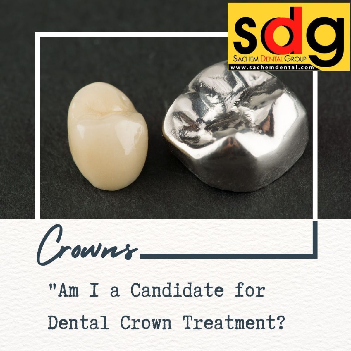 Candidacy for Dental Crowns Sachem Dental Group