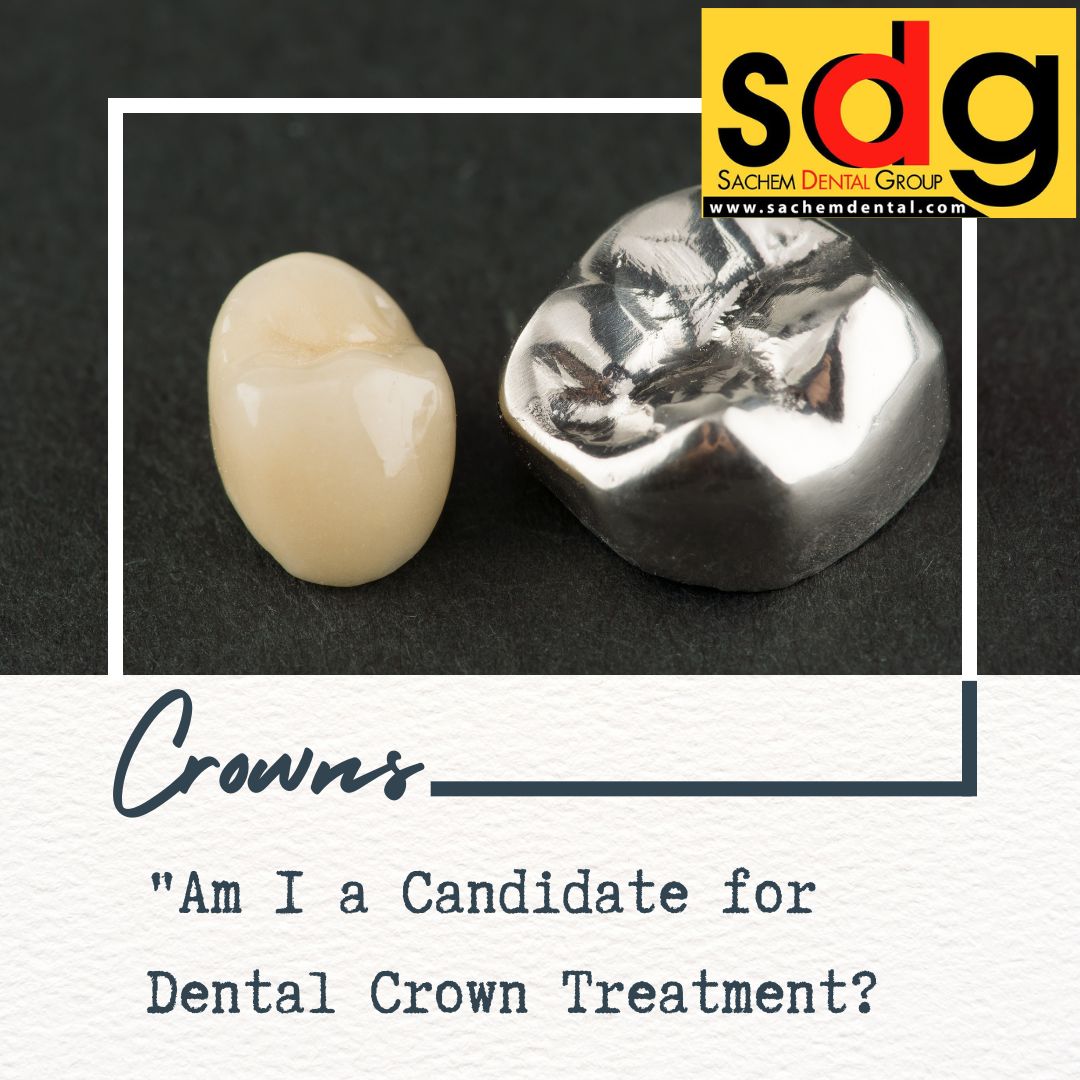 Am I a candidate for dental crowns (Long Island)