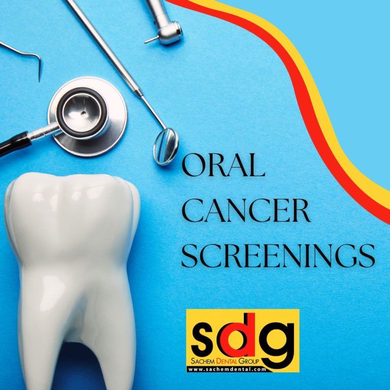 Oral Cancer Screenings Sachem Dental Group