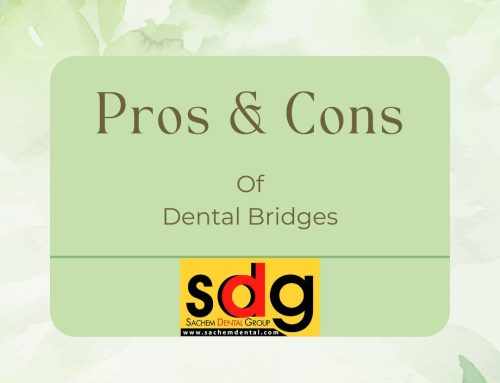 Pros and Cons of Dental Bridges | Suffolk County