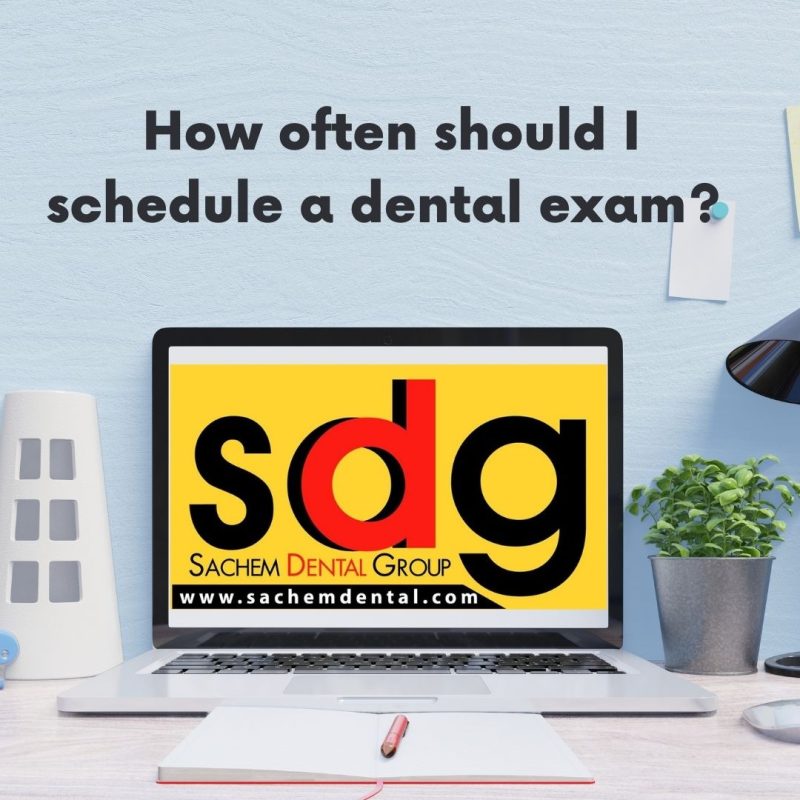 Dental Exams How Often Should I Schedule? Sachem Dental Group
