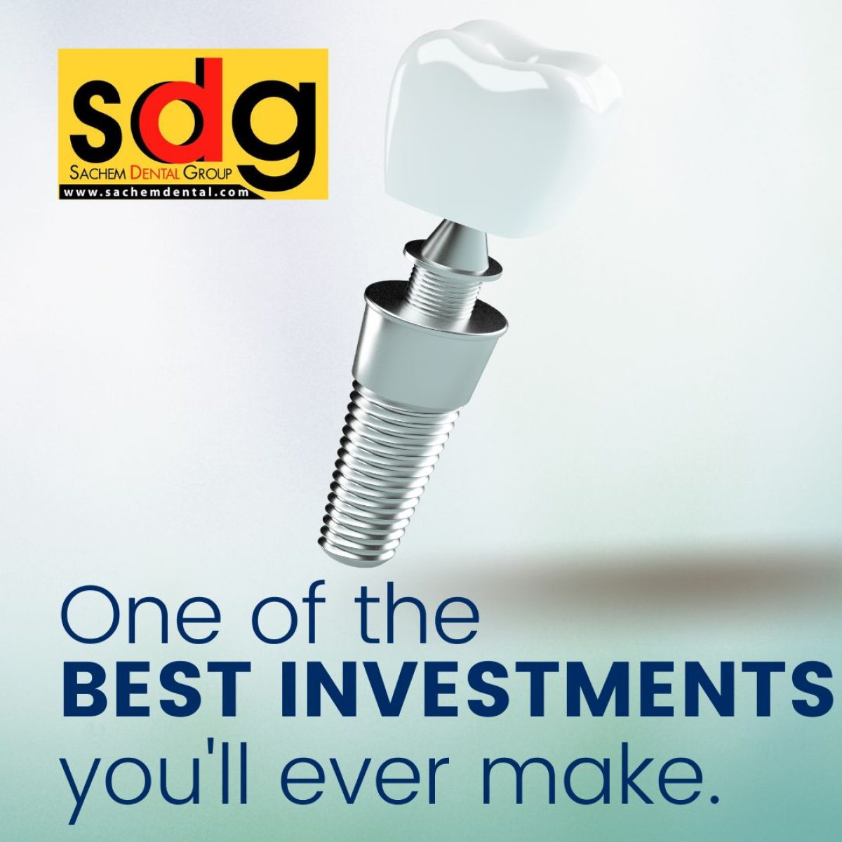 Missing Teeth? Dental Implants are the Best Investment You’ll Ever Make