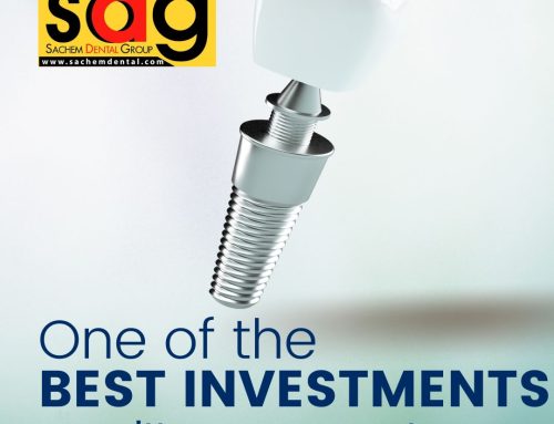 Missing Teeth? Dental Implants are the Best Investment You’ll Ever Make