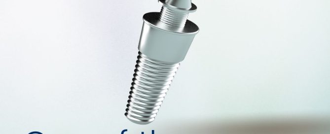 missing teeth replacement