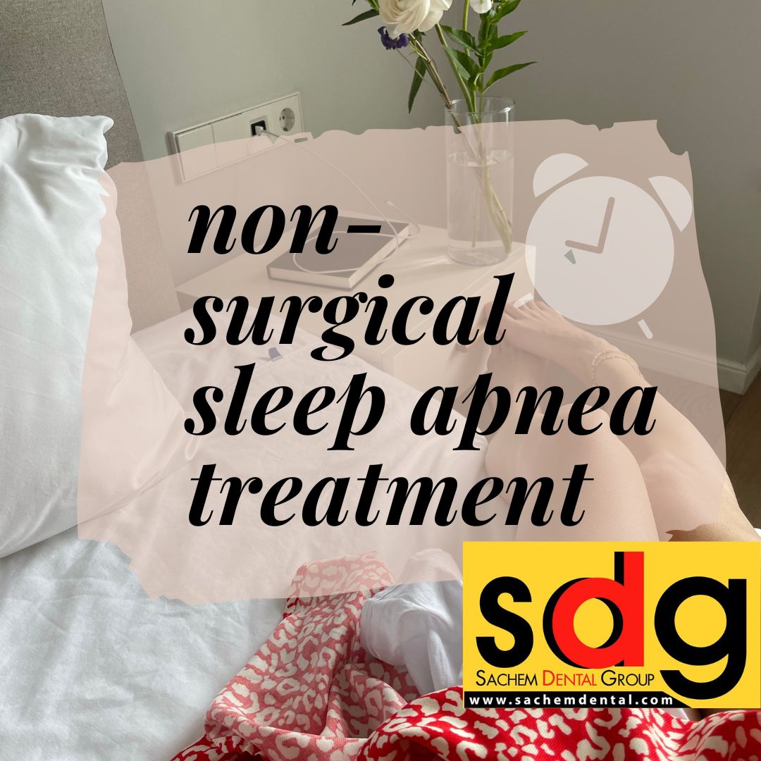 non-surgical treatment for sleep apnea
