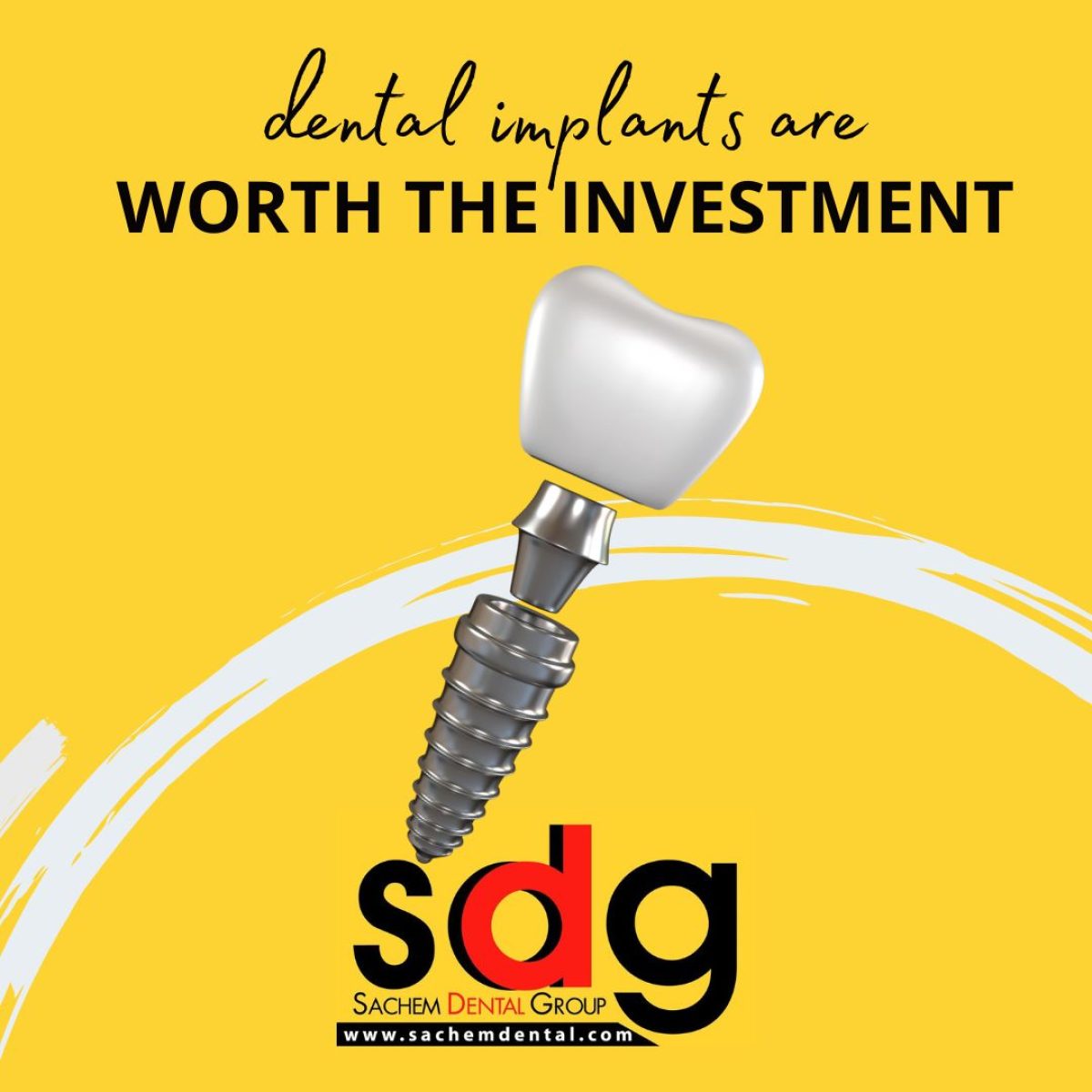 Why The Cost Of Dental Implants Is Worth The Investment Sachem Dental Group 0678