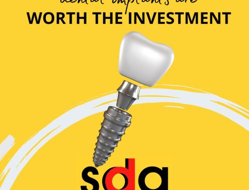Why the Cost of Dental Implants is Worth the Investment