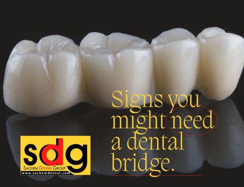 5 Signs You Might Need a Dental Bridge