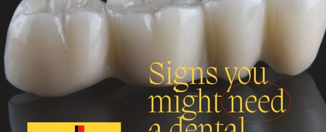 Do I need a dental bridge?